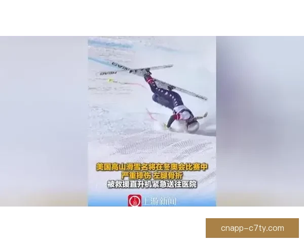 林赛沃恩晒腿部X光称成仿生人